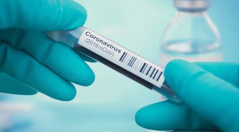 Coronavirus: Kano Isolation Hospital is Ready says CMD
